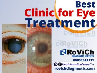 Best clinic for Eye