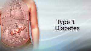 Best place for diabetes diagnosis