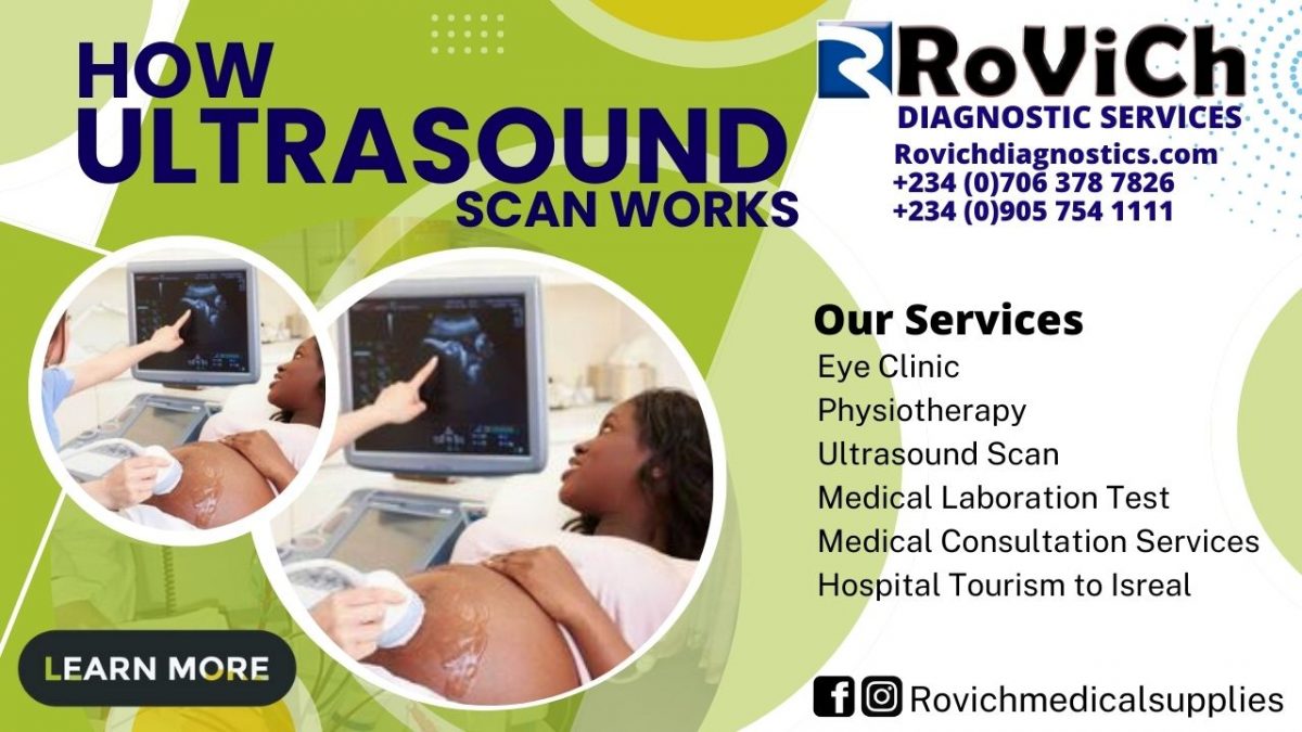 Importance-of-Ultrasound-Scan-Rovich-1200x675.jpg