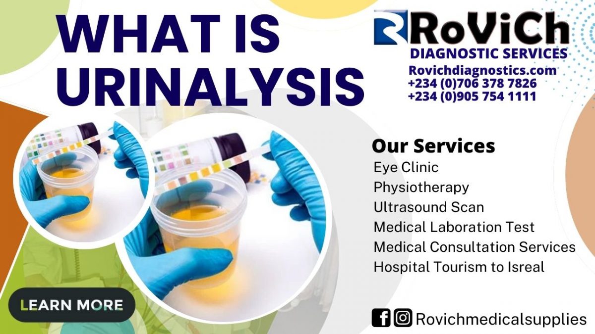 What-is-Urinalysis-Rovich-1200x675.jpg