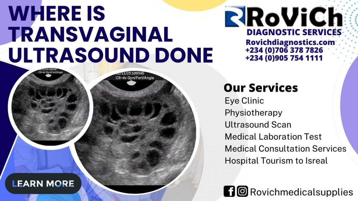 Where-is-Transvaginal-Ultrasound-Done-Rovich-1200x675.jpg