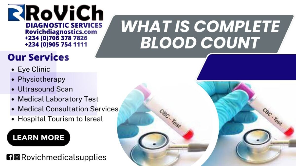 Best-Complete-Blood-Count-1200x675.jpg