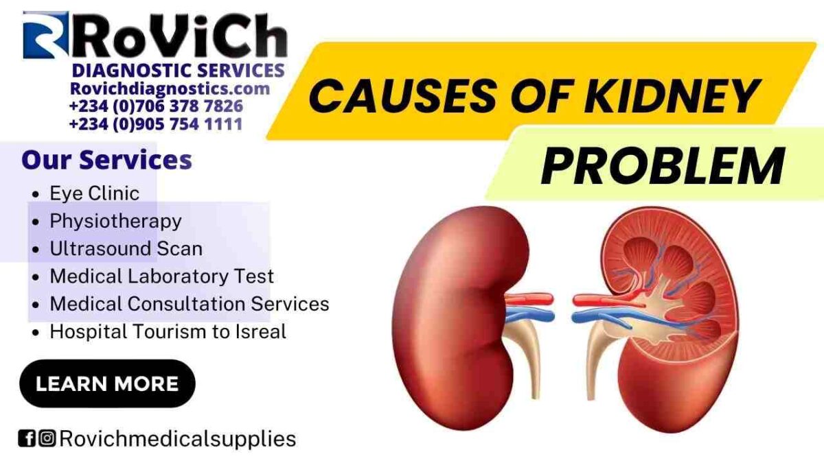 Causes-of-Kidney-Problem-1-1200x675.jpg