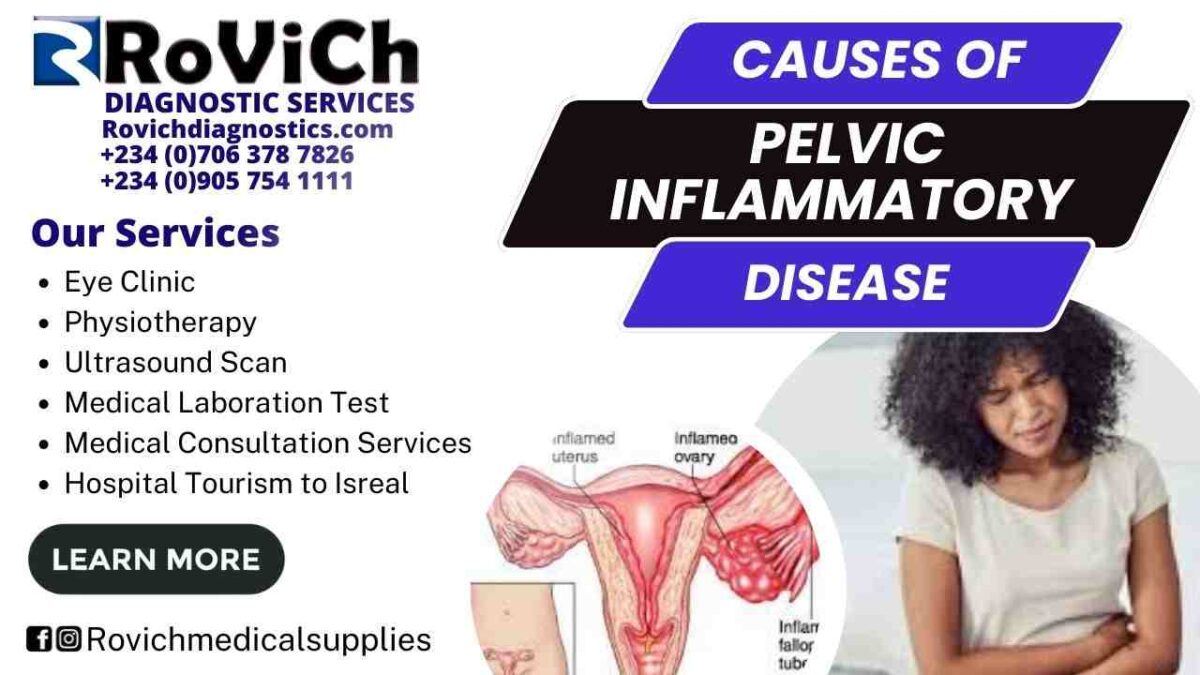 Causes-of-Pelvic-Inflammatory-Disease-1200x675.jpg