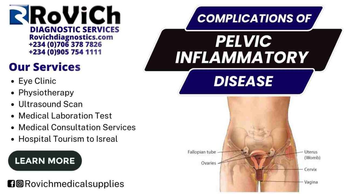 Complications-of-Pelvic-Inflammatory-Disease-1200x675.jpg