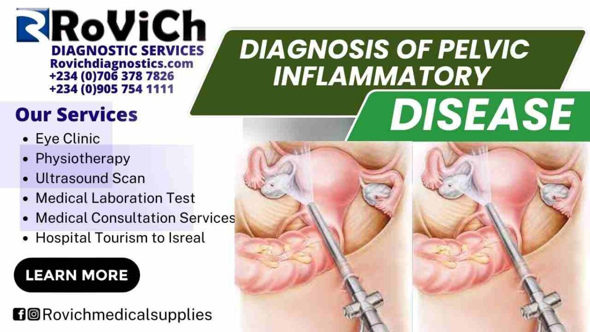 Diagnosis-of-Pelvic-Inflammatory-Disease-1200x675.jpg