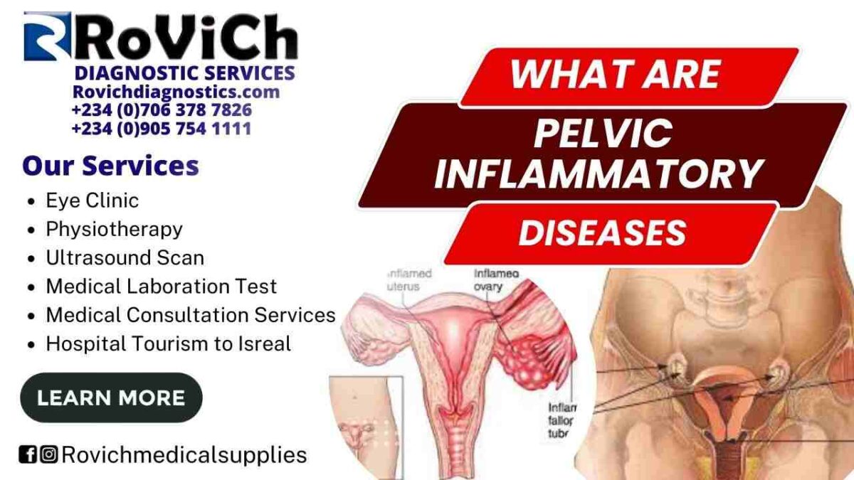 What-is-Pelvic-Inflammatory-Disease-Rovich-Diagnostics-1200x675.jpg